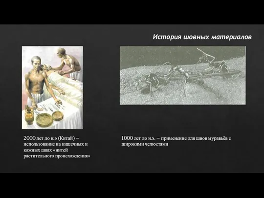 История шовных материалов 2000 лет до н.э (Китай) – использование на кишечных