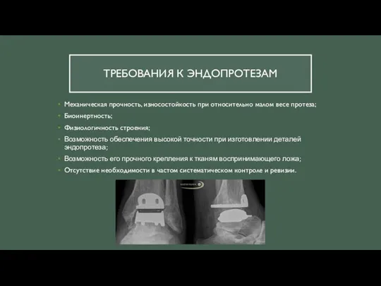 ТРЕБОВАНИЯ К ЭНДОПРОТЕЗАМ Механическая прочность, износостойкость при относительно малом весе протеза; Биоинертность;