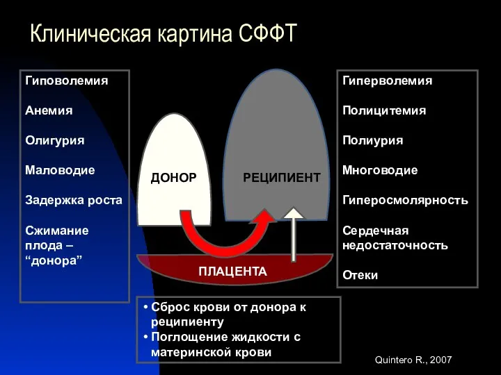 Клиническая картина СФФТ Гиповолемия Анемия Олигурия Маловодие Задержка роста Сжимание плода –