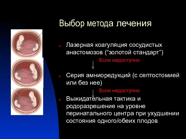 Выбор метода лечения Лазерная коагуляция сосудистых анастомозов (“золотой стандарт”) Если недоступно Серия