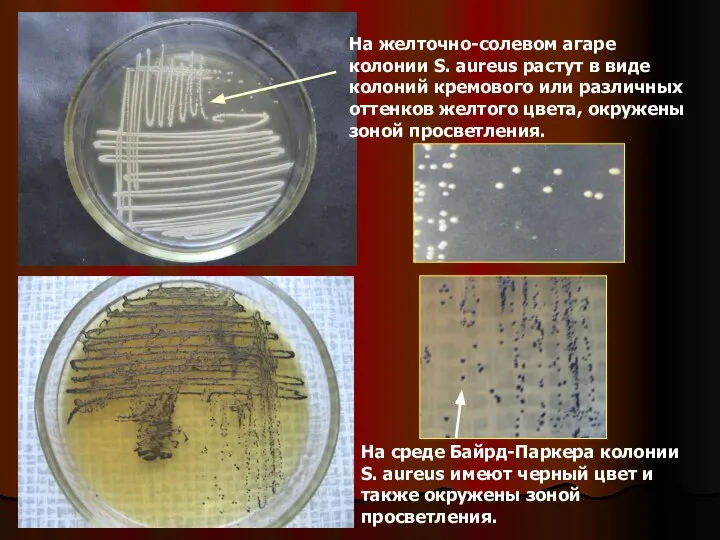 На желточно-солевом агаре колонии S. аureus растут в виде колоний кремового или