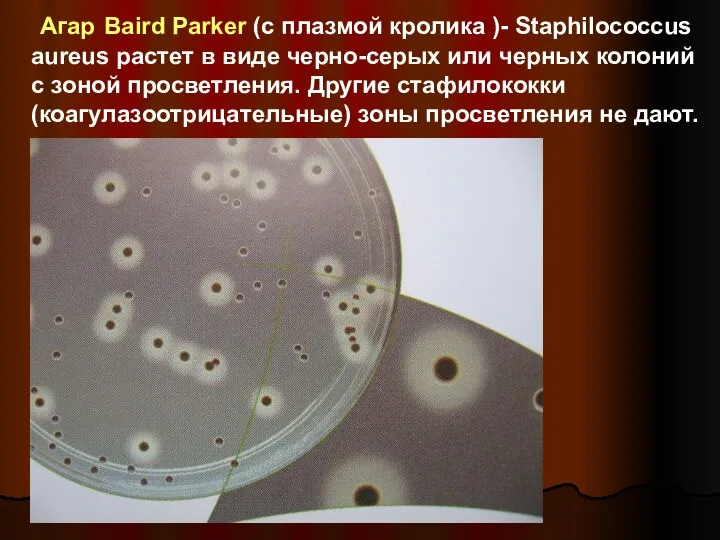 Агар Baird Parker (с плазмой кролика )- Staphilоcoccus aureus растет в виде