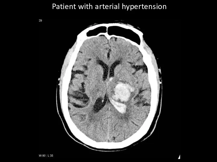 Patient with arterial hypertension