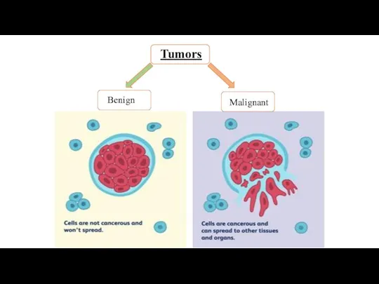 Tumors Benign Malignant