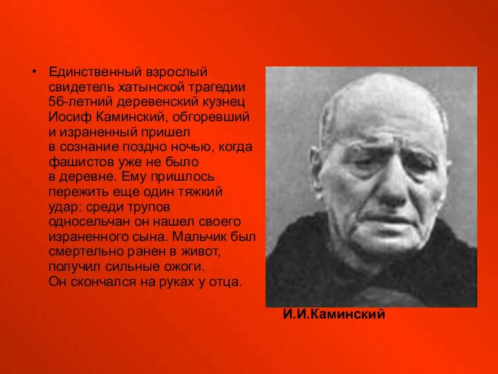 Единственный взрослый свидетель хатынской трагедии 56-летний деревенский кузнец Иосиф Каминский, обгоревший и