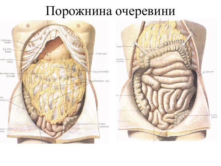 Порожнина очеревини