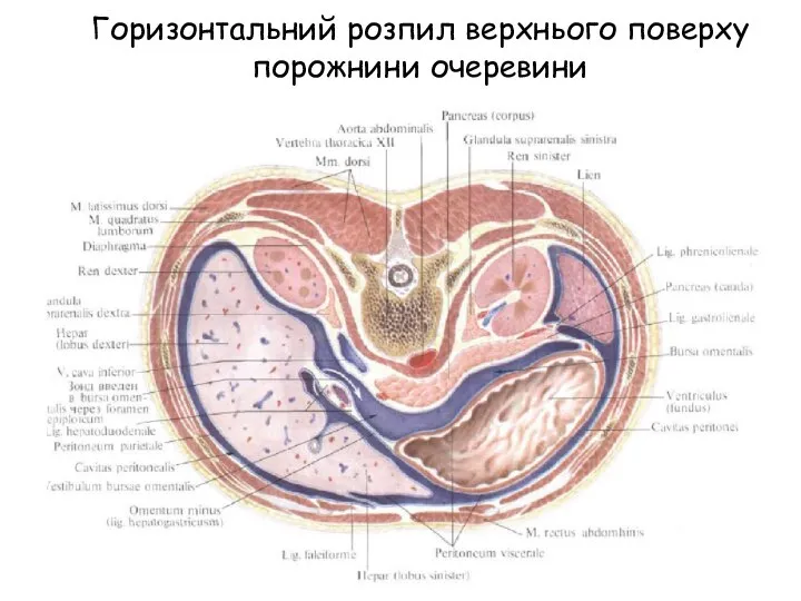 Горизонтальний розпил верхнього поверху порожнини очеревини