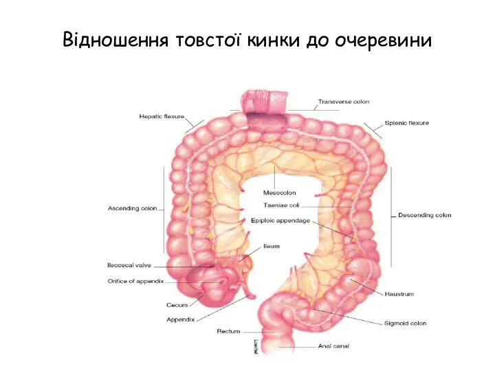 Відношення товстої кинки до очеревини