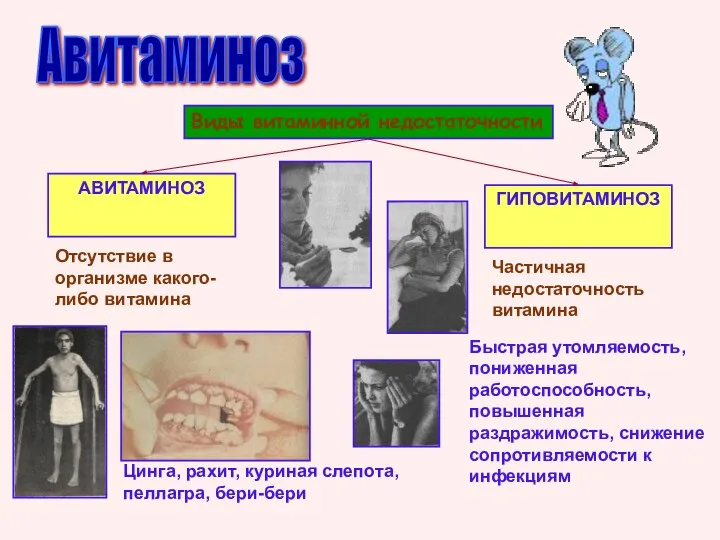 Авитаминоз Виды витаминной недостаточности АВИТАМИНОЗ ГИПОВИТАМИНОЗ Отсутствие в организме какого-либо витамина Цинга,