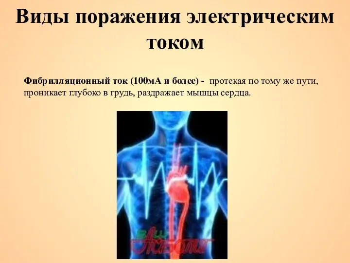 Фибрилляционный ток (100мА и более) - протекая по тому же пути, проникает