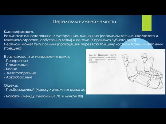 Переломы нижней челюсти Классификация. Различают: односторонние, двусторонние, одиночные (переломы ветви мыщелкового и