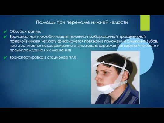 Помощь при переломе нижней челюсти Обезболивание; Транспортная иммобилизация теменно-подбородочной пращевидной повязкой(нижняя челюсть