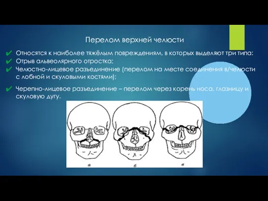 Перелом верхней челюсти Относятся к наиболее тяжёлым повреждениям, в которых выделяют три