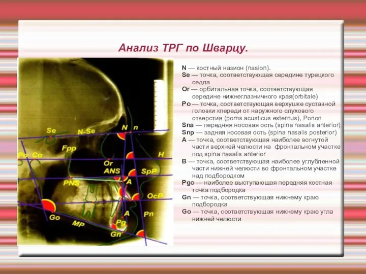 Анализ ТРГ по Шварцу. N — костный назион (nasion). Se — точка,