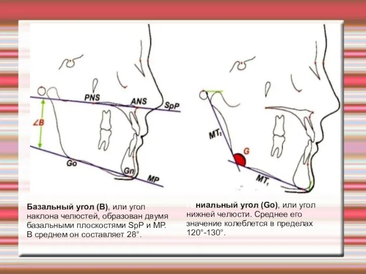 Гониальный угол (Gо), или угол нижней челюсти. Среднее его значение колеблется в