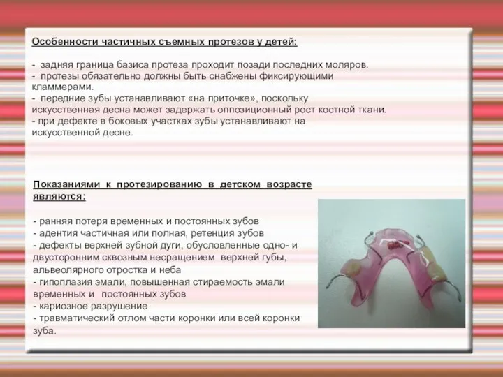 . Особенности частичных съемных протезов у детей: - задняя граница базиса протеза