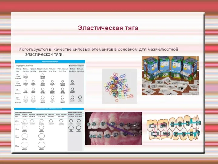 Эластическая тяга Используются в качестве силовых элементов в основном для межчелюстной эластической тяги.