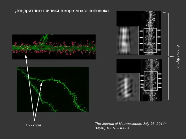 The Journal of Neuroscience, July 23, 2014 • 34(30):10078 –10084 Дендритные шипики