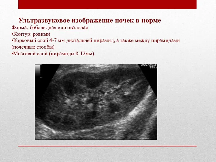 Ультразвуковое изображение почек в норме Форма: бобовидная или овальная •Контур: ровный •Корковый