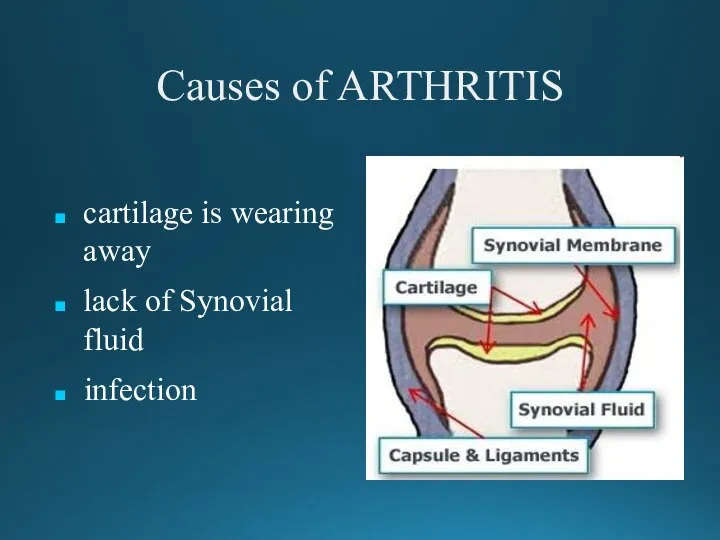 Causes of ARTHRITIS cartilage is wearing away lack of Synovial fluid infection