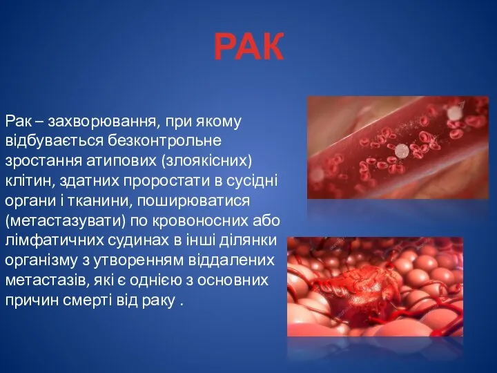 РАК Рак – захворювання, при якому відбувається безконтрольне зростання атипових (злоякісних) клітин,