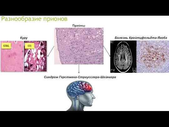 Разнообразие прионов Куру Болезнь Кройтцфельдта-Якоба Синдром Герстмана-Страусслера-Шайнкера Прионы