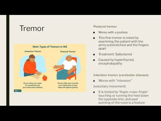 Tremor Postural tremor Worse with a posture This fine tremor is noted