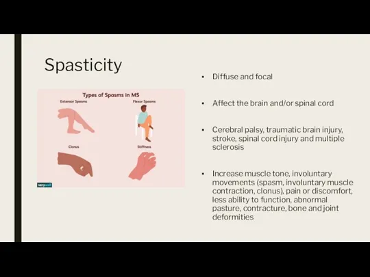 Spasticity Diffuse and focal Affect the brain and/or spinal cord Cerebral palsy,