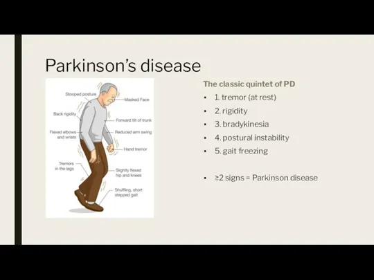 Parkinson’s disease The classic quintet of PD 1. tremor (at rest) 2.