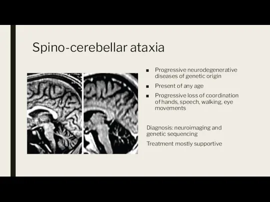 Spino-cerebellar ataxia Progressive neurodegenerative diseases of genetic origin Present of any age