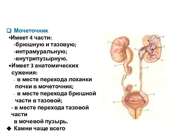 Мочеточник Имеет 4 части: брюшную и тазовую; интрамуральную; внутрипузырную. Имеет 3 анатомических