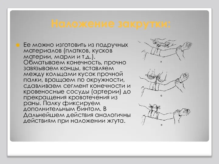 Наложение закрутки: Ее можно изготовить из подручных материалов (платков, кусков материи, марли