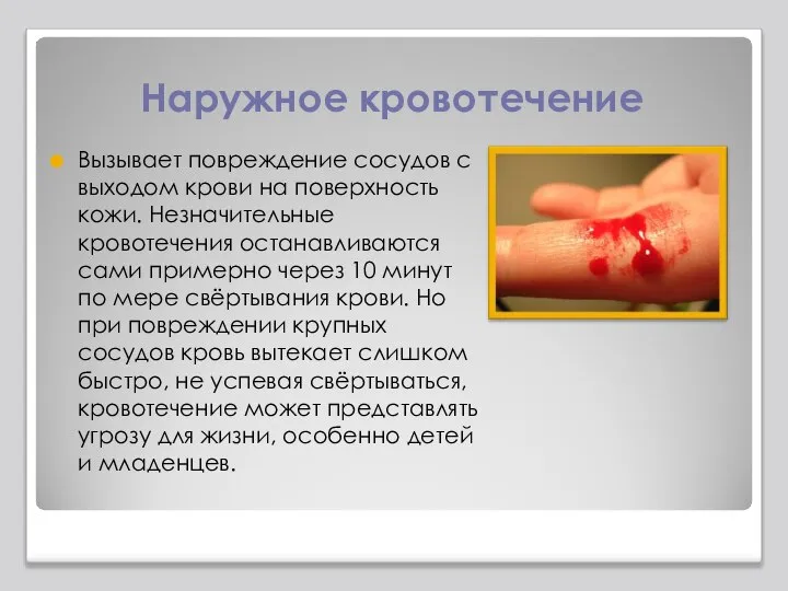 Наружное кровотечение Вызывает повреждение сосудов с выходом крови на поверхность кожи. Незначительные