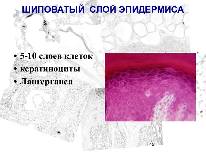 ШИПОВАТЫЙ СЛОЙ ЭПИДЕРМИСА 5-10 слоев клеток кератиноциты Лангерганса