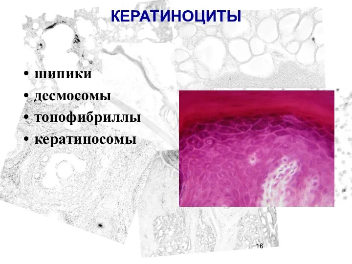 КЕРАТИНОЦИТЫ шипики десмосомы тонофибриллы кератиносомы