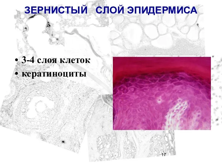 ЗЕРНИСТЫЙ СЛОЙ ЭПИДЕРМИСА 3-4 слоя клеток кератиноциты