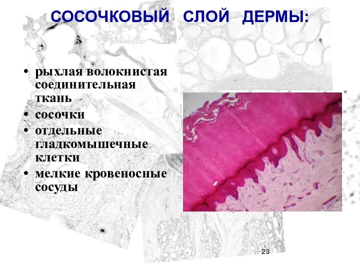СОСОЧКОВЫЙ СЛОЙ ДЕРМЫ: рыхлая волокнистая соединительная ткань сосочки отдельные гладкомышечные клетки мелкие кровеносные сосуды