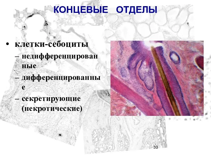 КОНЦЕВЫЕ ОТДЕЛЫ клетки-себоциты недифференцированные дифференцированные секретирующие (некротические)