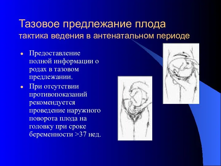 Тазовое предлежание плода тактика ведения в антенатальном периоде Предоставление полной информации о