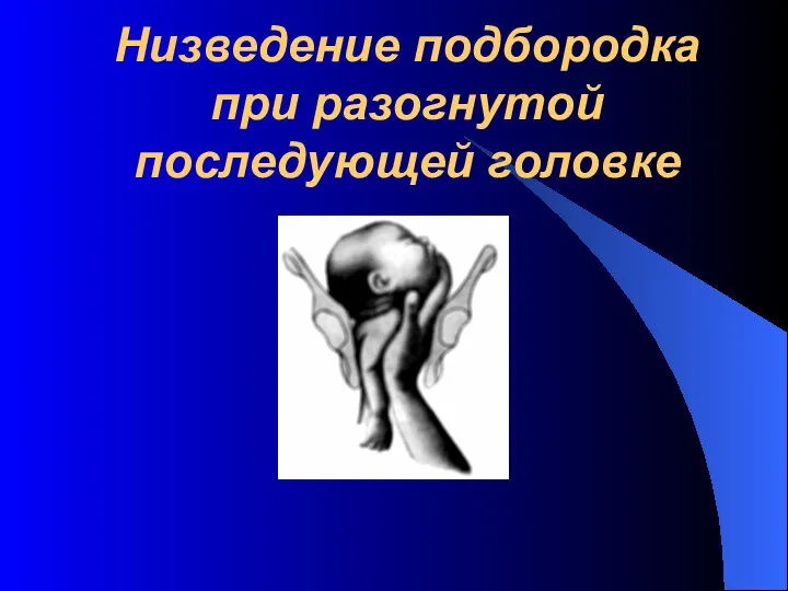 Низведение подбородка при разогнутой последующей головке