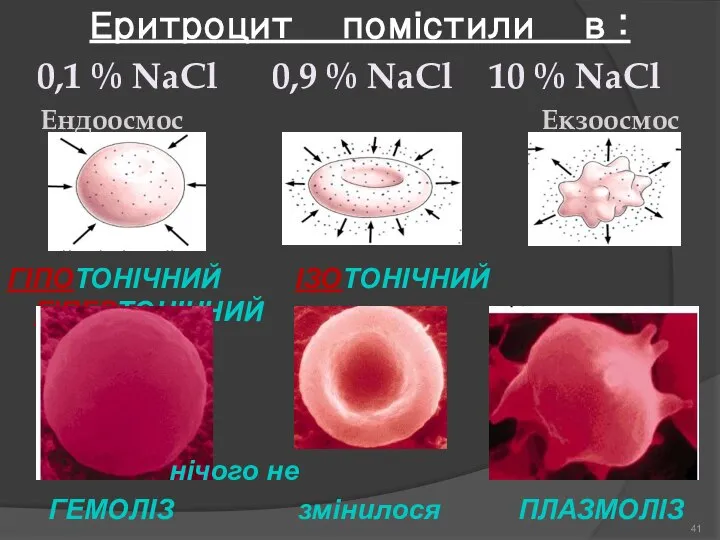 Еритроцит помістили в : 0,1 % NaCl 0,9 % NaCl 10 %