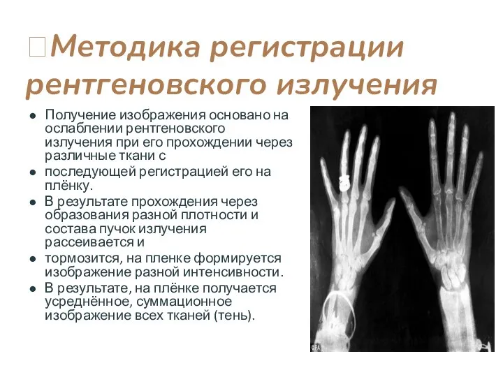 Методика регистрации рентгеновского излучения Получение изображения основано на ослаблении рентгеновского излучения при