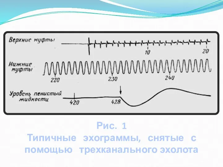 Рис. 1 Типичные эхограммы, снятые с помощью трехканального эхолота