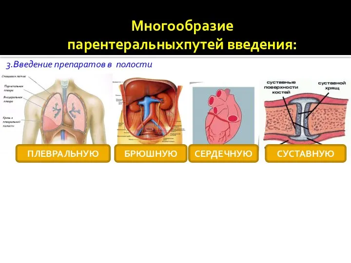 3.Введение препаратов в полости ПЛЕВРАЛЬНУЮ БРЮШНУЮ СЕРДЕЧНУЮ СУСТАВНУЮ Многообразие парентеральныхпутей введения: