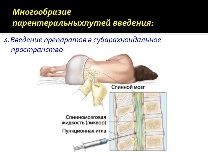 Многообразие парентеральныхпутей введения: 4.Введение препаратов в субарахноидальное пространство