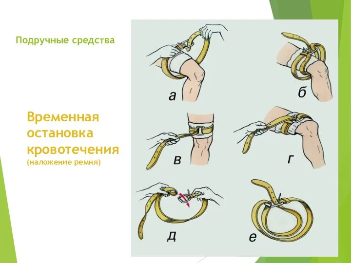 Подручные средства Временная остановка кровотечения (наложение ремня)