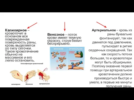 Классификация кровотечений Капилярное – кровоточит в основном вся поврежденная поверхность раны, кровь