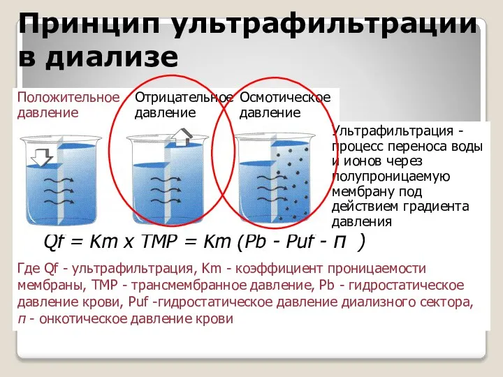 Принцип ультрафильтрации в диализе Qf = Km x TMP = Km (Pb