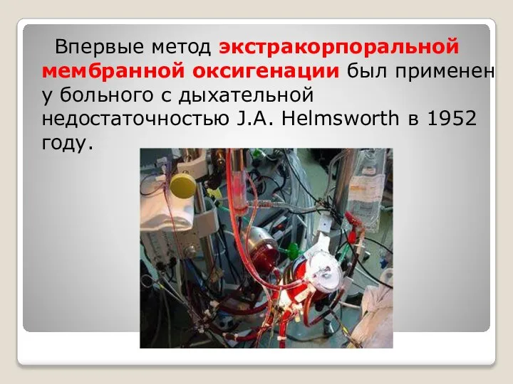 Впервые метод экстракорпоральной мембранной оксигенации был применен у больного с дыхательной недостаточностью