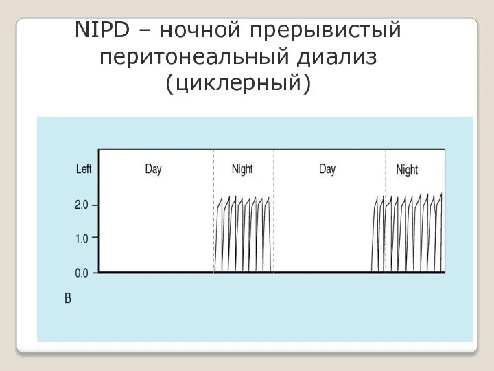 NIPD – ночной прерывистый перитонеальный диализ (циклерный)